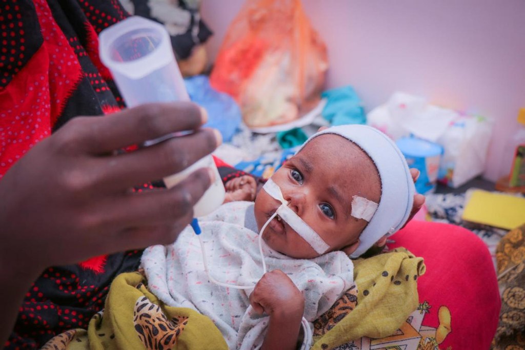 Fatima tient son fils dans ses bras alors qu'il est soigné pour une malnutrition aiguë sévère dans un hôpital d'Aden, au Yémen.