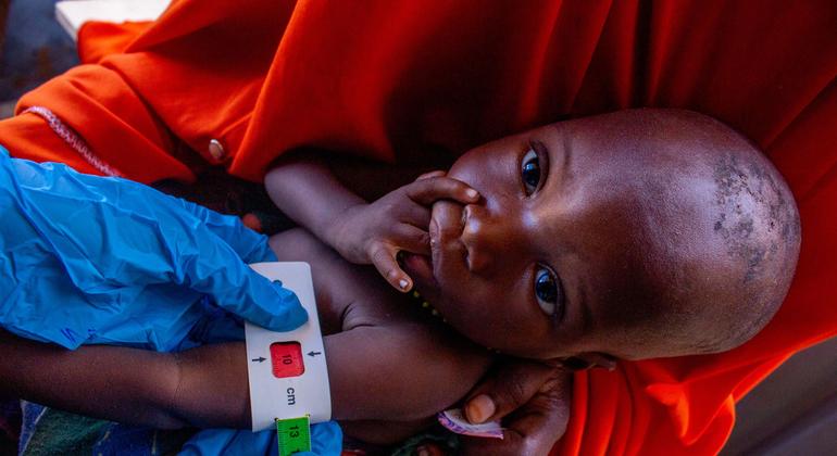 Годовалый Ахмед Мохаммед проходит обследование на предмет недоедания в штате Джубаланд, Сомали, где 1,8 миллиону детей до пяти лет угражает голод.