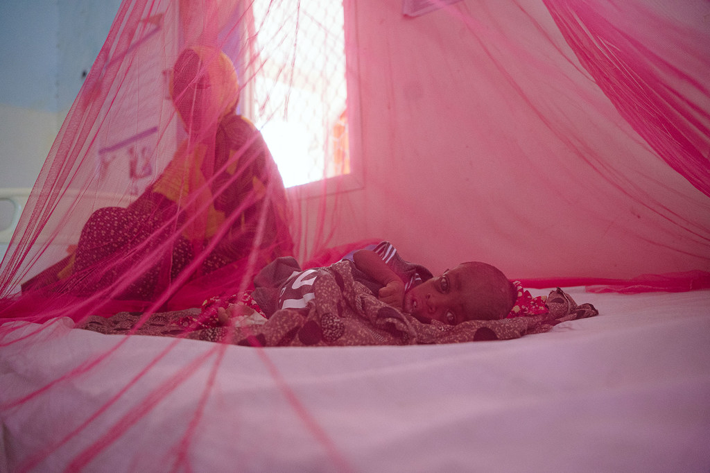 Un garçon de dix mois est soigné pour malnutrition sévère dans un hôpital du Puntland, en Somalie.