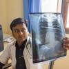 在印度，一名医生在检查x光片，看是否有肺部损伤，以确定病人是否罹患结核。