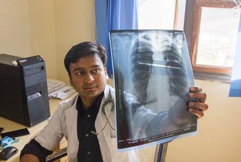 In India, a doctor checks a patient’s x-ray for lung damage, which may indicate tuberculosis.