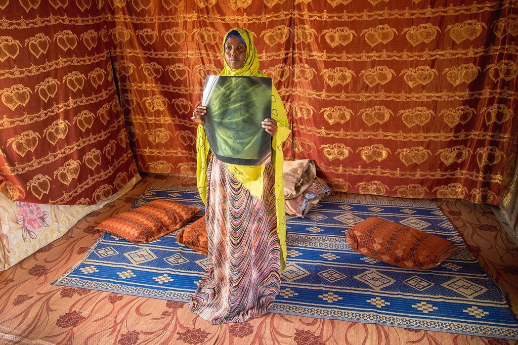 Fatouma Ismael Mahmoud, mkimbizi wa Somalia huko Djibouti, akishikilia x-ray ya kifua chake katika makazi yake katika kambi ya wakimbizi ya Ali Addeh.