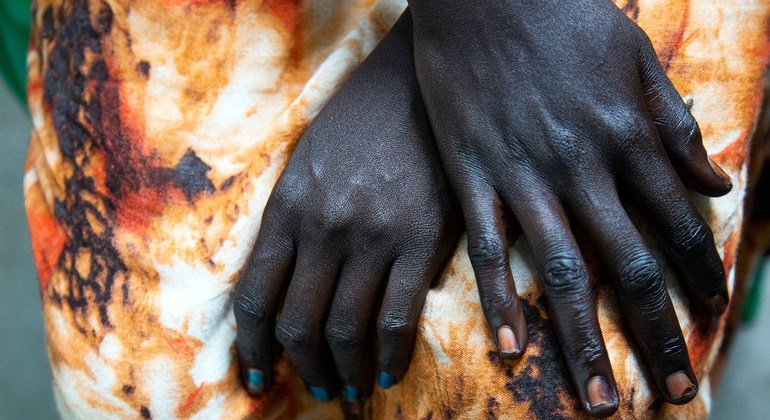一名被丈夫殴打的南苏丹妇女在她哥哥的房子里寻求庇护。