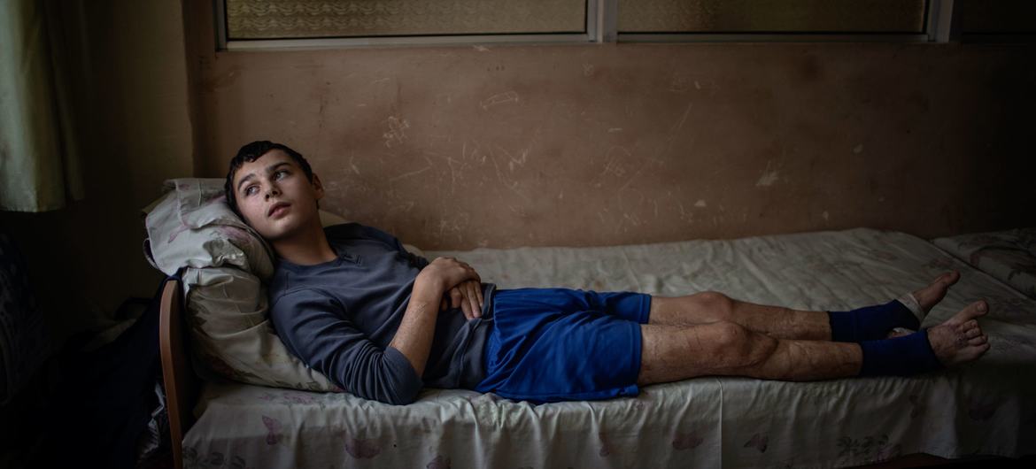 In Lviv, Ukraine, a 12-year-old boy rests on a bed at Saint Nicholas Pediatric Hospital. (file)