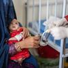 Пятимесячная девочка в афганской больнице получает молоко для лечения недоедания. 