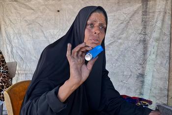 أم محمد المصري، نزحت من بلدة بيت حانون شمال غزة إلى الجنوب. برغم مرضها إلا أنها تدير فرنا بدائية وقوده البلاستيك والكرتون.