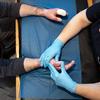 Медицинский работник в синих перчатках осматривает поврежденные руки пациента с ожогами, лежащего на синей медицинской простыне.