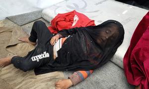 Las moscas vuelan sobre el hijo dormido de Abu Asr en la tienda en la que viven en Gaza.
