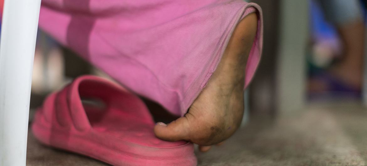 Una niña desplazada en Ocaña, Colombia