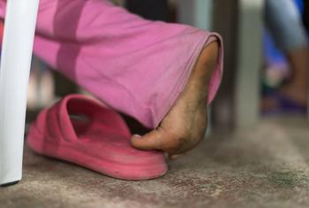 Una niña desplazada en Ocaña, Colombia