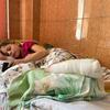 Une fillette de 11 ans se rétablit dans un hôpital de Lviv après avoir perdu ses jambes lors d'une attaque de missiles à la gare de Kramatorsk, en Ukraine.