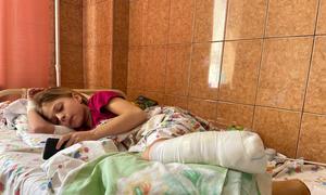 11-летняя девочка в больнице во Львове, потерявшая обе ноги в результате обстрела железнодорожной станции в Краматорске.   