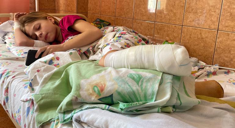 An 11-year-old girl recovers at a hospital in Lviv after losing her legs in a missile attack at Kramatorsk railway station in Ukraine.
