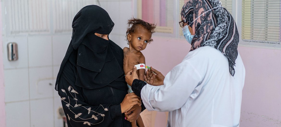 Criança de um ano e meio recebe tratamento para desnutrição no Iêmen. 