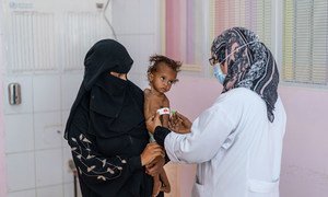 一个一岁多的女孩在也门一家医院接受营养不良治疗。