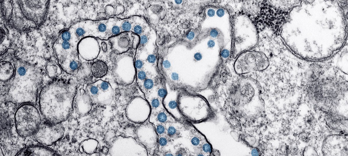 Imagem microscópica digitalmente aprimorada mostra em azul uma infecção por coronavírus.