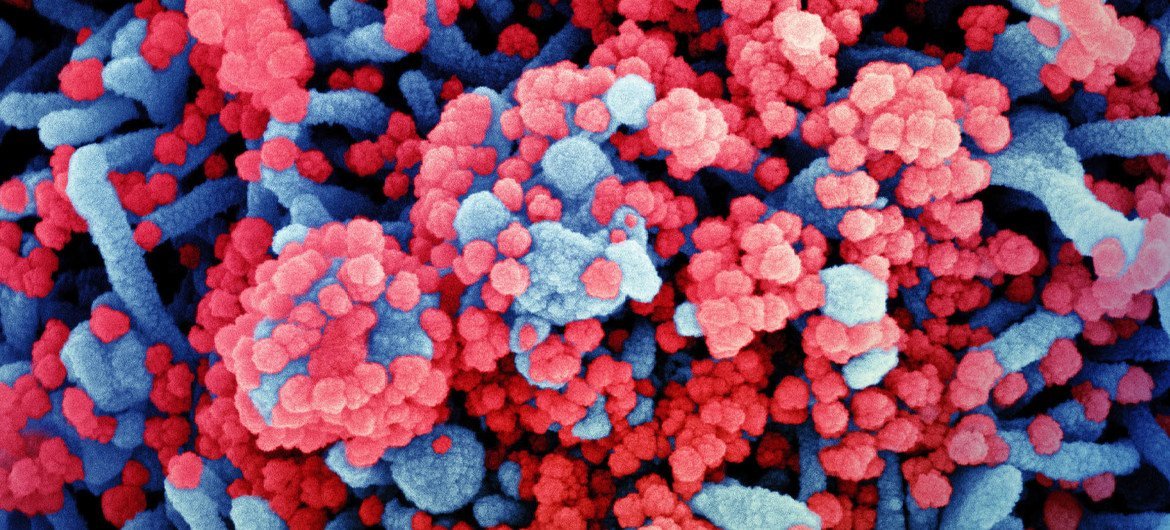 Colorized scanning electron micrograph of a cell (blue) heavily infected with SARS-CoV-2 virus particles (red).