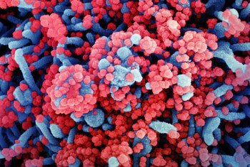 Micrographie électronique à balayage colorisée d'une cellule (bleu) fortement infectée par des particules virales du SRAS-CoV-2 (rouge).