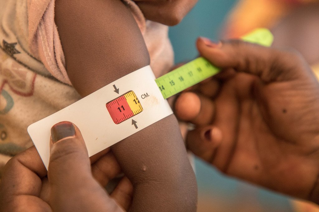 يعاني الكثير من الأطفال الصغار في النيجر من آثار سوء التغذية.