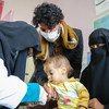 طفل يبلغ من العمر 9 أشهر يعالج من سوء التغذية الحاد الوخيم في مستشفى في اليمن.