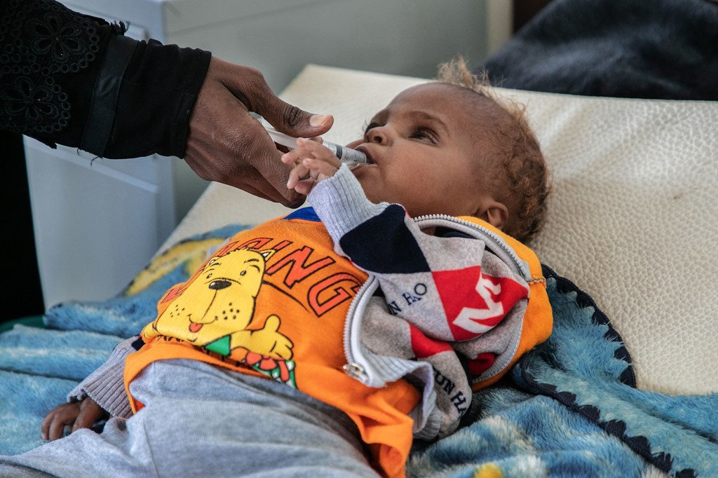 Un bebé de 18 meses, que perdió un ojo por una enfermedad, es tratado en un hospital de Saná, en Yemen