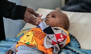An eighteen-month -baby, who has lost an eye due to disease, is treated at a hospital in Sana’a, Yemen.