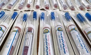 Iraq produce sus primeras pruebas para detectar el coronavirus COVID-19 con el apoyo de la Organización Mundial de la Salud.