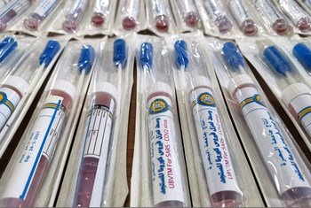 الدفعة الأولى من مجموعات اختبار فيروس الكورونا المنتجة محليا في العراق لدعم المختبرات الوطنية.