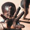 بقع سوداء على يد طفل في زامبيا