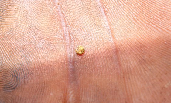 An artisanal miner holds a small nugget of gold dug in Sikasso in Mali.