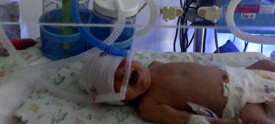 طفل يتلقى الدعم التنفسي في عيادة حديثي الولادة في أوكرانيا.