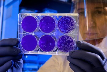 Una científica examina los resultados de una prueba de partículas del virus de la gripe.