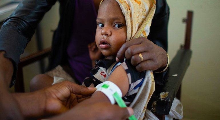 Niño en consulta por desnutrición en un centro de salud en Tigray, Etiopía.