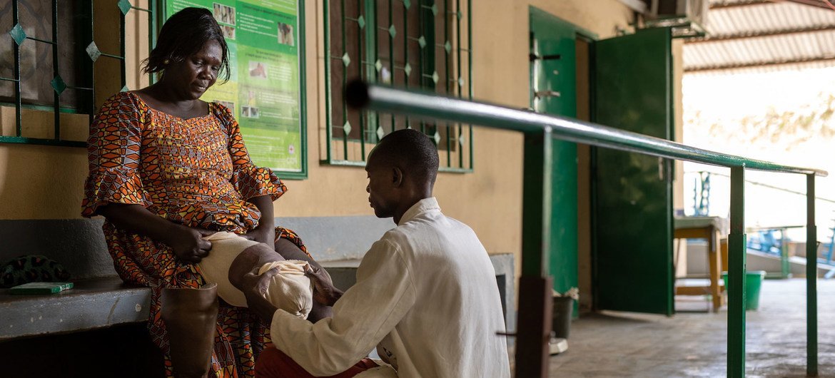 A 33-year old landmine survivor tries on a new prosthesis at the fitting and rehabilitation centre in Kabalaye, Chad.