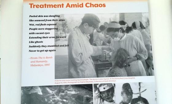 Fotografia na výstave jadrového odzbrojenia liečeného pacienta, ktorý prežil atómovú bombu.
