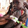 Un enfant malnutri est évalué dans une clinique au Soudan du Sud.