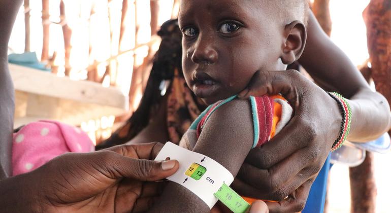 A malnourished child is assessed at a nutrition clinic in Fangak county, South Sudan.
