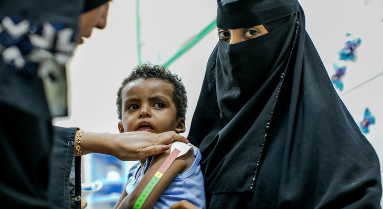 السيدة اليمنية آسيا السيد علي، العاملة في مجال الصحة، تفحص طفلا صغيرا يعاني من سوء التغذية الحاد.