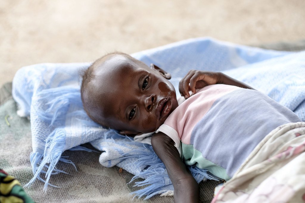 Un bébé âgé de huit mois traité pour malnutrition sévère dans l'hôpital pour enfants d'Al Sabbah à Juba, au Soudan du Sud (photo d'archives).
