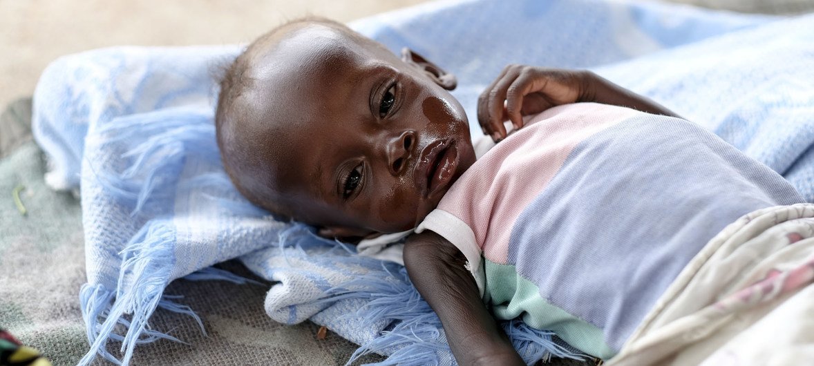 Menino de oito meses de idade com desnutrição grave no Hospital Infantil Al Sabbah em Juba, Sudão do Sul.
