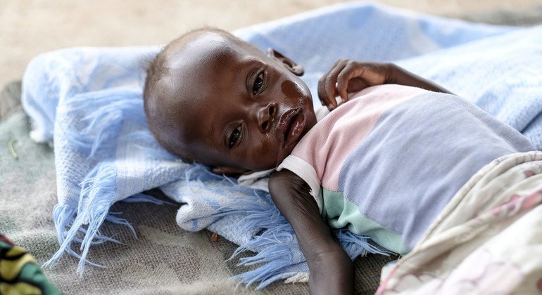Un bébé âgé de huit mois traité pour malnutrition sévère dans l'hôpital pour enfants d'Al Sabbah à Juba, au Soudan du Sud (photo d'archives).