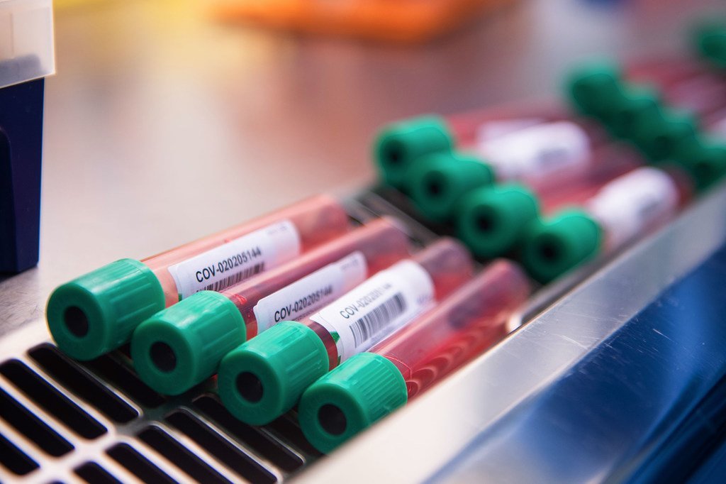 Une équipe de scientifiques de l'Institut Jenner de l'université d'Oxford et de l'Oxford Vaccine Group est à la recherche d'un vaccin contre le coronavirus