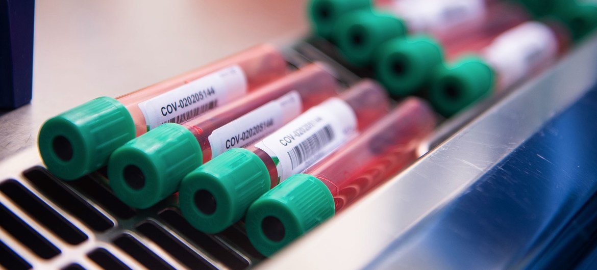 牛津大学的一组科学家正在研究一种针对新型冠状病毒的疫苗。