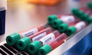 A team of scientists at Oxford University’s Jenner Institute and Oxford Vaccine Group is trailing a vaccine against the coronavirus.