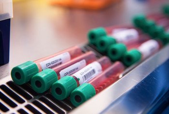 Une équipe de scientifiques de l'Institut Jenner de l'université d'Oxford et de l'Oxford Vaccine Group est à la recherche d'un vaccin contre le coronavirus