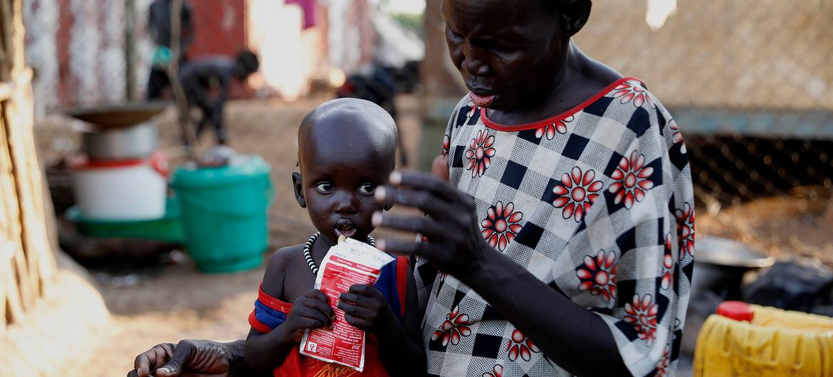 在南苏丹，一位祖母在照顾她17个月大营养不良的孙子。