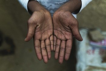 The hands of a survivor who was rescued from a bangle making factory in Hyderabad, India in 2015. 