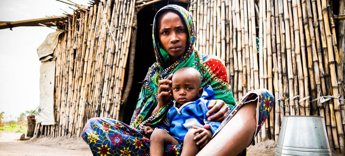 मध्य अफ़्रीका गणराज्य की एक महिला जो अत्यन्त गम्भीर कुपोषण से प्रभावित है.