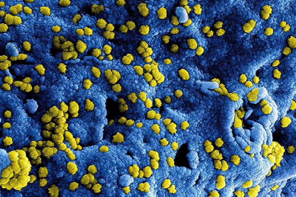 Le virus du coronavirus MERS, imagé numériquement.