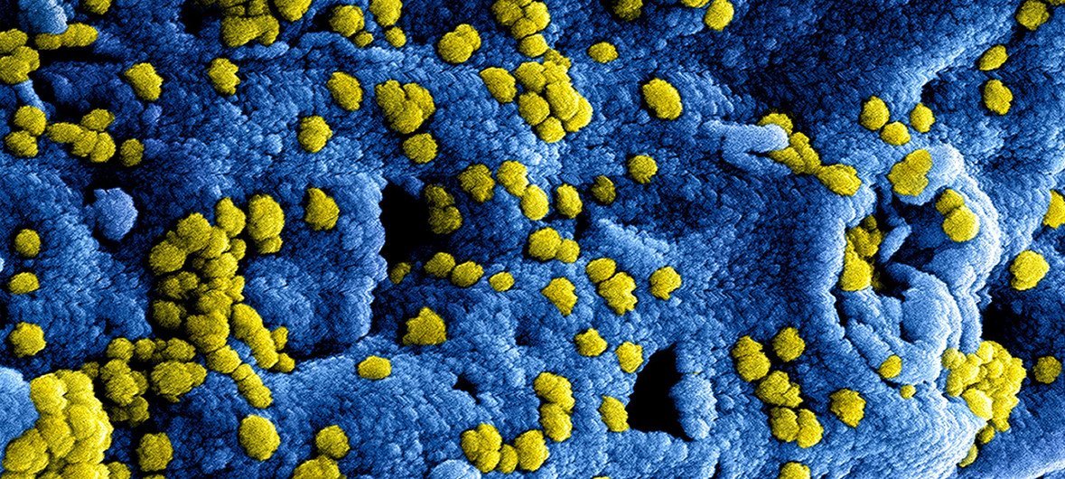 Imagen digital del coronavirus.Instituto Nacional de Enfermedades Alérgicas e Infecciosas de Estados Unidos